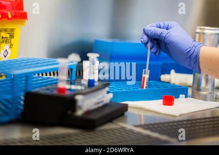 Tests BIOFIRE ® FilmArray (laboratoire bioMérieux) Spécifiquement dédié au nouveau coronavirus (SRAS-COV-2) qui fournit des résultats à 45 minutes de Banque D'Images