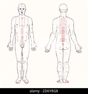 Ensemble de corps (avant et arrière) schéma d'acupuncture avec points rouges, Doodle dessiné à la main, croquis de style pop art, noir et blanc illustration médicale Banque D'Images
