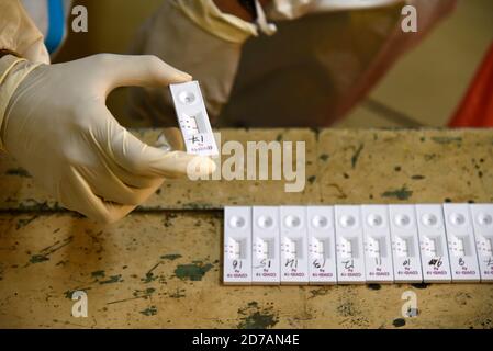 Guwahati, Assam, Inde. 21 octobre 2020. Un travailleur de la santé qui a obtenu un résultat négatif du test rapide d'antigène Covid-19 (RAT), dans un centre de collecte de Swab en prévision du festival durga puja, à Guwahati, en Inde, le 21 octobre 2020. Au total, 9 72 00,379 échantillons ont été testés jusqu'en octobre 20. Selon l'Université Johns Hopkins, qui a compilé des données COVID-19 de partout dans le monde, le nombre de morts en Inde est le troisième pire. Crédit : David Talukdar/ZUMA Wire/Alay Live News Banque D'Images