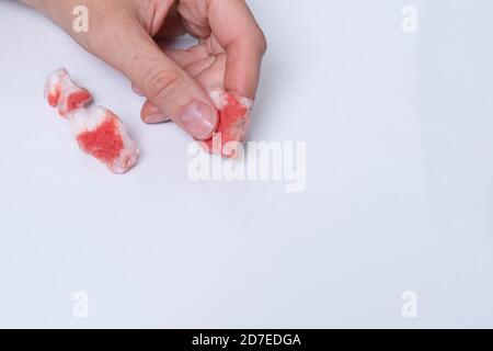 La main féminine atteinte d'un doigt appuie un bandage sur une plaie pour arrêter le saignement, bandages souillés avec du sang Banque D'Images