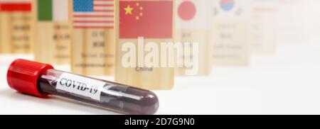 Tubes à essai contenant du sang de coronavirus dans un laboratoire Banque D'Images