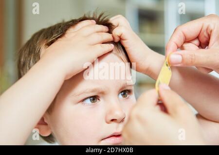 L'enfant reçoit du plâtre sur sa bosse sur son front à le pédiatre Banque D'Images