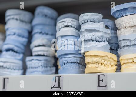 Lieu de stockage des modèles de plâtre des mâchoires humaines dans une clinique orthodontique. Moulages dentaires de contrôle et de diagnostic Banque D'Images