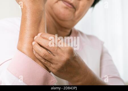 les femmes âgées rayent le bras de la démangeaison sur l'eczéma, les soins de santé et le concept de médecine Banque D'Images