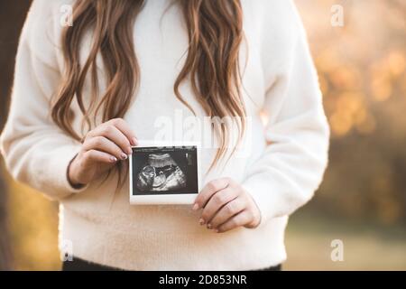 Femme enceinte portant un chandail tricoté tenant une photo de dépistage de bébé sur le ventre sur l'arrière-plan de la nature à l'extérieur. Maternité. Maternité. Soins de santé. Banque D'Images