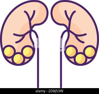 Icône de couleur RVB de la maladie de la pierre des reins Illustration de Vecteur