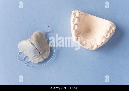 Plaque d'orthodontie amovible et plâtre moulé de la mâchoire de l'enfant sur fond bleu. Banque D'Images