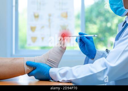 Gros plan gants médicaux le médecin examine la jambe de la douleur nerveuse de la femme dans le pied, fasciite plantaire, ostéophyte en clinique, concept de M. Banque D'Images