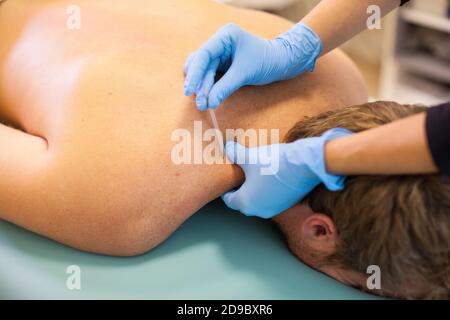 Le médecin colle l'aiguille dans le corps de l'homme sur l'acupuncture Banque D'Images