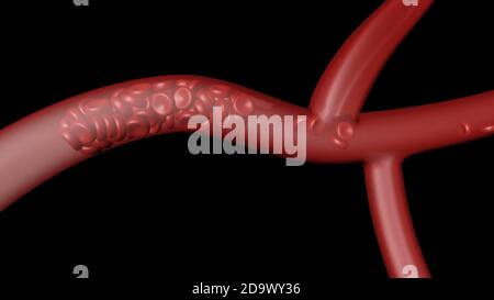 Animation formation rouge thrombus Santé rendu médical 3d Banque D'Images