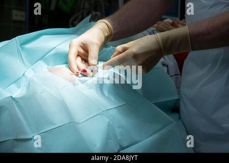 un médecin effectue une ponction du genou dans une salle d'opération avec une canule et une seringue Banque D'Images