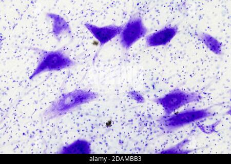 Micrographe clair des cellules nerveuses (grandes, pourpres) et des cellules de support (neuroglie, points bleu foncé). La ramification du corps nerveux sont des dendrites. Banque D'Images