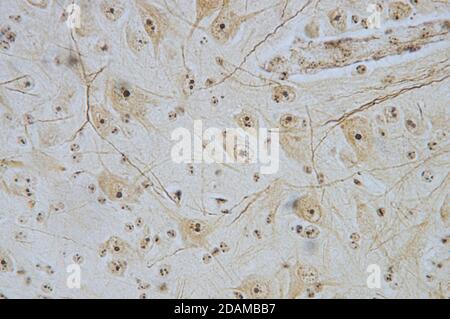 Micrographe léger des neurones (cellules nerveuses) de la moelle épinière. Banque D'Images