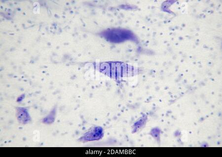 Micrographe clair des cellules nerveuses (grandes, pourpres) et des cellules de support (neuroglie, points bleu foncé). La ramification du corps nerveux sont des dendrites. Banque D'Images