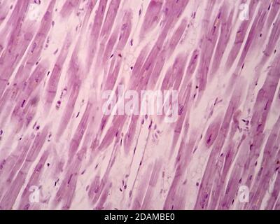 Muscle cardiaque, micrographe léger. Banque D'Images