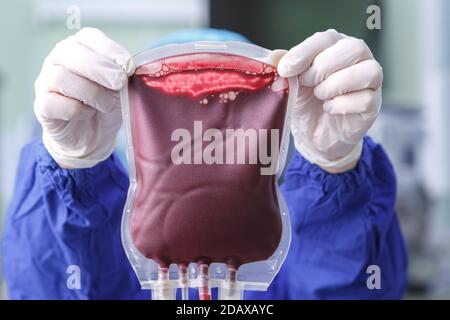 Mains gantées d'un professionnel de la santé tenant un sac de le sang du donneur est proche Banque D'Images