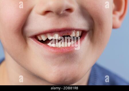 Un Portrait Macro D Une Bouche De Bebe Avec Les Deux Premieres Petites Dents Blanches Sortant Des Gencives Le Petit Enfant A Un Sourire Sur Son Visage Les Deux Dents Photo Stock