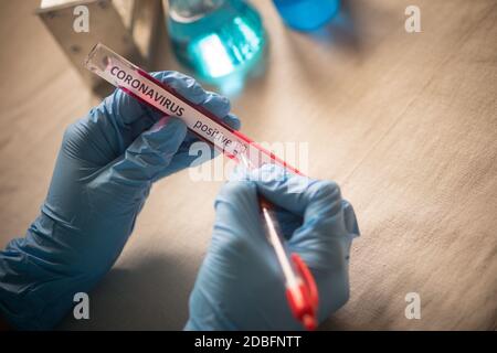 Photographie conceptuelle des mains d'un médecin tenant et marquant un tube à essai comme positif pour la présence de coronavirus (COVID-19). Banque D'Images