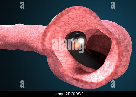 Dispositif médical pour vérifier l'état des intestins et détecter les maladies gastro-intestinales. La coloscopie et la gastroscopie diagnostic médical. 3d illust Banque D'Images