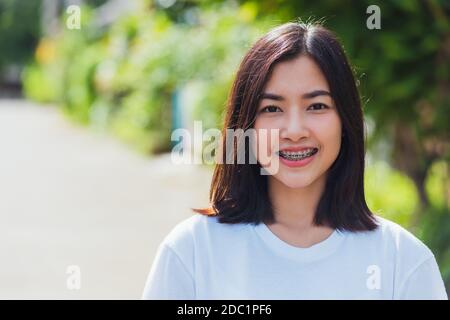 Portrait de l'asiatique de l'adolescence belle jeune femme sourire ont des accolades dentaires sur les dents riant en plein air, la médecine et le concept de dentisterie Banque D'Images