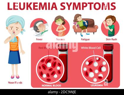 Illustration graphique illustrant les symptômes de la leucémie Illustration de Vecteur