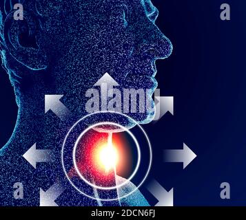 Mal de gorge, corps humain, anatomie. Brûlure dans la gorge. Irritation douloureuse de la gorge souvent aggravée par la déglutition. Infections virales Banque D'Images