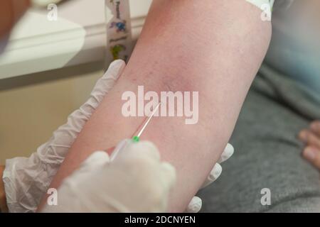 Main d'une infirmière appliquant une aiguille médicale pour le sang extraction hors de la veine sur une main d'un patiente Banque D'Images