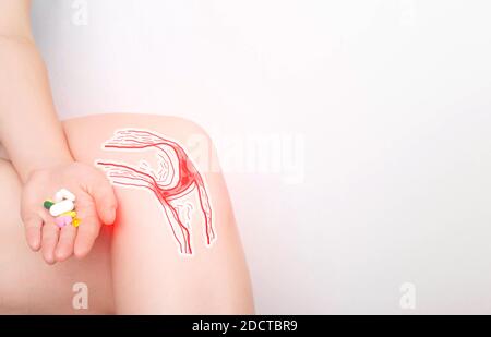 La fille tient une poignée de pilules dans sa main pour la douleur dans l'articulation du genou. Concept de médicaments pour le traitement et la restauration du tissu cartilagineux dans le Th Banque D'Images