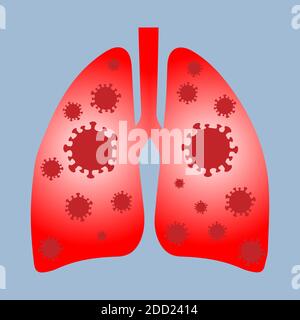 Poumons humains infectés par le coronavirus, vecteur conceptuel Illustration de Vecteur