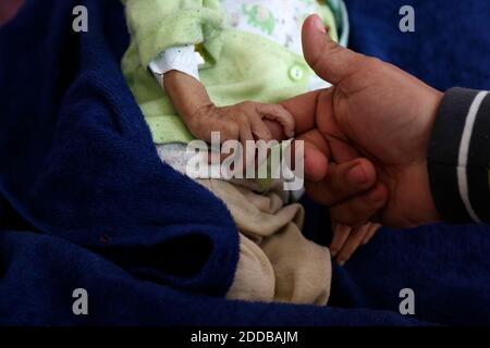 Sanna, Yémen. 24 novembre 2020. Le 24 novembre 2020, un enfant malnutris est observé au service de traitement de la malnutrition de l'hôpital Al-Sabeen de Sanaa, au Yémen. Le chef du Fonds des Nations Unies pour l'enfance (UNICEF) a averti lundi qu'il n'y a pas de temps à perdre car le Yémen déchiré par la guerre se dirige vers la famine. Credit: Mohammed Mohammed/Xinhua/Alay Live News Banque D'Images