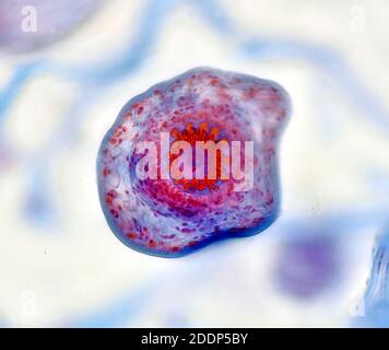 photomicrographe à fond clair, diail parasite du ténia de chien, encysted. Kystes hydatide de ténias chez le chien, TS. Banque D'Images