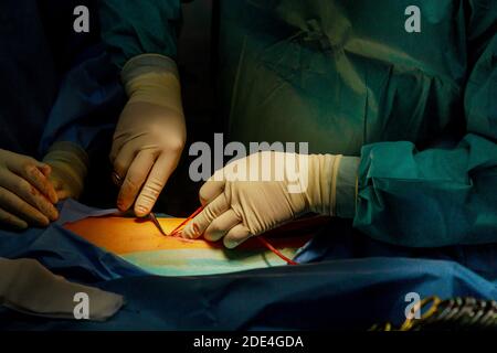 Instruments médicaux avec le médecin dans la salle d'opération, le chirurgien effectue une opération sur la jambe du patient, coupe la peau avec un scalpel mains Banque D'Images