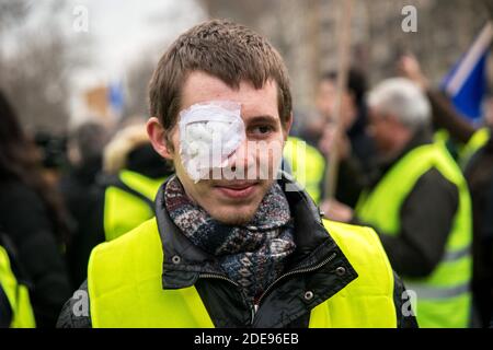 Franck Didron (20) victime d'une balle de LBD 40, il a perdu l'œil le 1er décembre 2018, à l'acte 12 de la protestation des gilets jaunes à Paris, en France, le 02 février 2019. Photo de Denis Prezat/avenir photos/ABACAPRESS.COM Banque D'Images