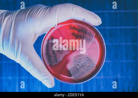 Main dans un gant tenant une boîte de Petri avec les bactéries Steptococcus Phemolifticus G, Streptococcus Agalactiae, Streptococcus Phemolifticus Banque D'Images