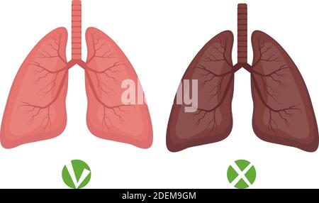 Maladies des poumons et des poumons en santé ou infographies des fumeurs isolées sur fond blanc. Illustration vectorielle Illustration de Vecteur