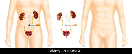 une cigarette nocive pour les organes du rein Banque D'Images
