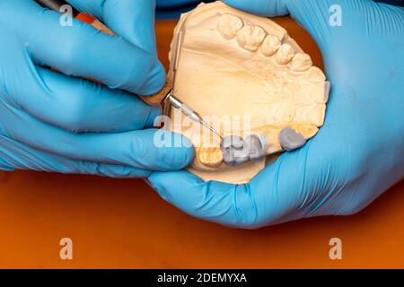 Technicien dentaire utilisant une brosse avec des implants dentaires en céramique dans son laboratoire. Banque D'Images