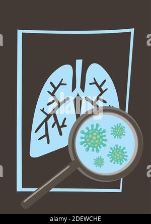 Coronavirus maladie COVID-19 infection médicale dans les poumons de rayons X. Illustration vectorielle Illustration de Vecteur