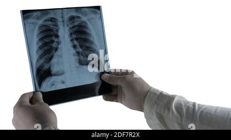 Rayons X des poumons isolés sur un endroit blanc pour le texte, le gros plan, l'image des poumons humains, le médecin analyse l'image des poumons. Banque D'Images