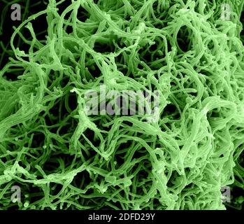 Micrographe électronique à balayage colorisé des particules filamenteuses du virus Ebola qui bourgeonnaient d'une cellule VERO E6 infectée de façon chronique (grossissement de 35000x). Banque D'Images