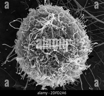 Micrographe électronique à balayage des particules filamenteuses du virus Ebola qui bourgeonnent à partir d'une seule cellule de l'OVERO E6 infectée de façon chronique (grossissement de 25 000 fois). IMA Banque D'Images