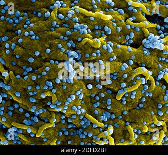 Micrographe électronique à balayage colorisé des particules du virus de Marburg (bleu) en bourgeonnement et fixées à la surface des cellules infectées de la VERO E6 (jaune). Banque D'Images