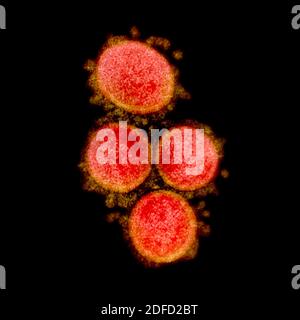 Micrographe électronique de transmission des particules du virus du SRAS-COV-2, isolées d'un patient. Image capturée et couleur améliorée à la résolution intégrée NIAID Banque D'Images