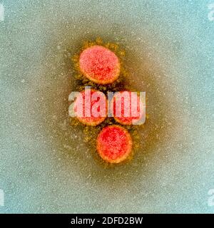 Micrographe électronique de transmission des particules du virus du SRAS-COV-2, isolées d'un patient. Image capturée et couleur améliorée à la résolution intégrée NIAID Banque D'Images