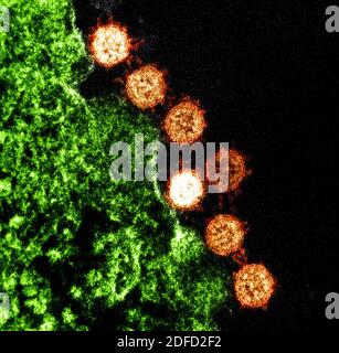 Micrographe électronique à transmission colorisée du syndrome respiratoire aigu sévère (SRAS) particules virales (orange) trouvées près de la périphérie d'un infecte Banque D'Images