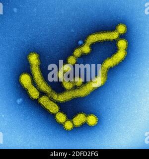 Micrographe électronique à transmission colorisée des particules du virus de la grippe SW31 (souche porcine) colorées négativement. Crédit : NIAID. Banque D'Images