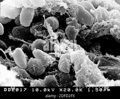 Micrographe électronique à balayage représentant une masse de bactéries Yersinia pestis (la cause de la peste bubonique) dans l'intestin antérieur du vecteur de puce. Crédit: NIA Banque D'Images