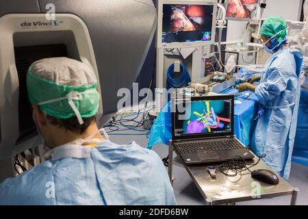 La chirurgie rénale conservatrice robotique guidée par l'image assistée par la modélisation 3D, cette modélisation 3D du rein avec sa tumeur située en violet, guide les s. Banque D'Images