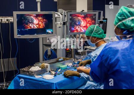 La chirurgie rénale conservatrice robotique guidée par l'image assistée par la modélisation 3D, cette modélisation 3D du rein avec sa tumeur située en violet, guide les s. Banque D'Images