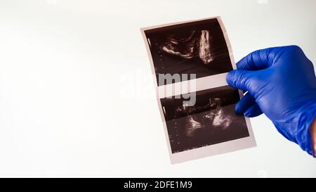 Échographie transrectale de la prostate.le médecin examine le patient par radiographie. Banque D'Images